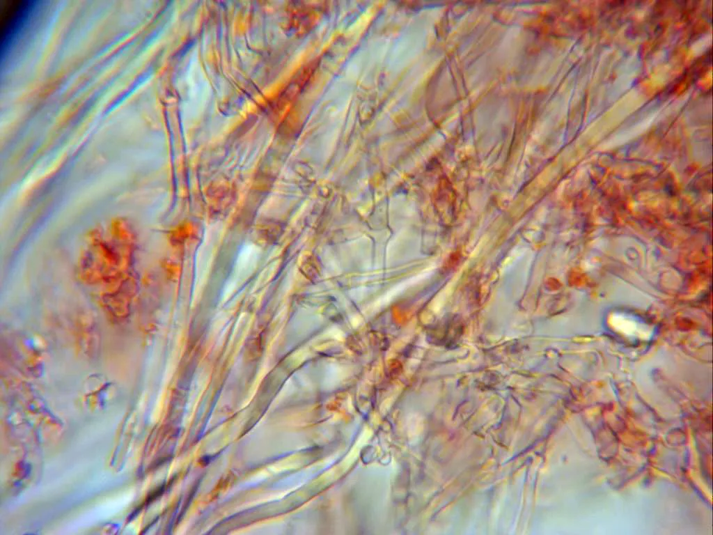 Microscopía de Trechispora farinacea - 10 - Sistema monomitico